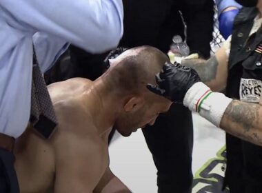 MMA kovotas neteko piršto